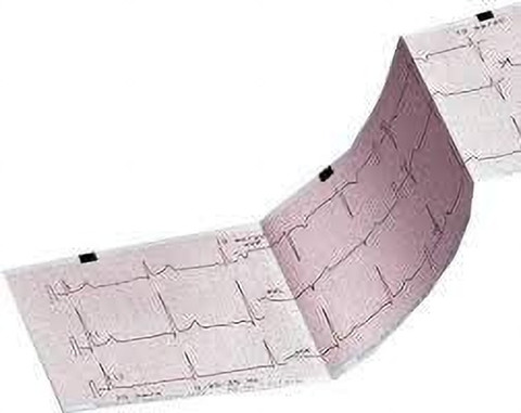 Flipkart.com | Medroof ECG Graph Paper Thermal Paper Cardiology ...