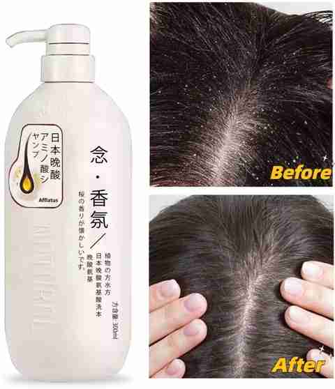 Katie JAPANESE SHAMPOO Japan's No.1 Shampoo Anti Hair Loss Hair