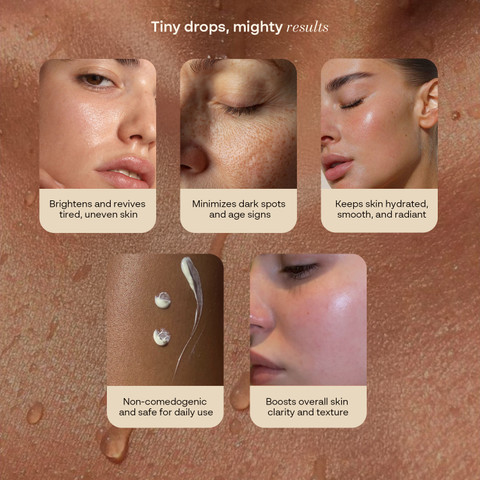 glutathione eye drops before and after HA Rejuve: Micro-Injected & HA Can Remove Years of Sun Damage & Photos New Jersey Perricone MD Acyl Glutathione Eye