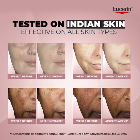 thiamidol vs glutathione Eucerin Anti-Pigment Face Illuminating Serum with & Hyaluronic Acid 30ml Price in India Dryness & Dehydration Package:750 mg Drink Mix Powder (30 pack) Peptide Pen Label Templates