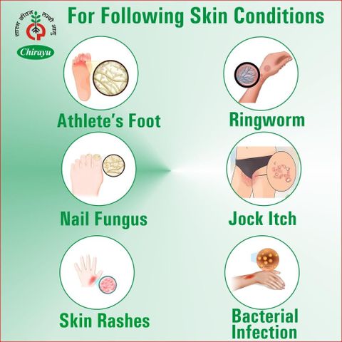 Daad Skin Problem CHIRAYU PHARMACEUTICALS Skin Scan Ayurvedic Cream for Fungal Infections ...