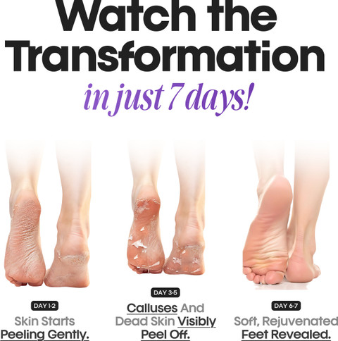 Frizty Foot Mask Peeling Feet Mask, Foot Peel Off Mask, Peeling