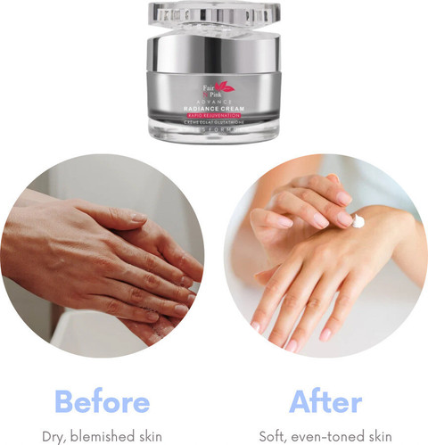 glutathione antioxidant near me Who Offers Glutathione IV Therapy in San Antonio, TX?