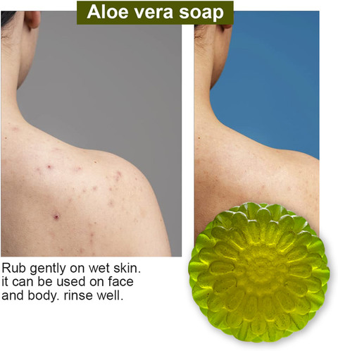hilft aloe vera gegen entzündungen Aloe Vera Kalt-Warm Ultra Gel mit CBD und Arnika (250/100ml) main image 1