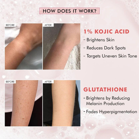 mCaffeine Brightening Tan Removal Soap- 1% Kojic Acid & Glutathione -  Reduces Dark Spots - Price in India, Buy mCaffeine Brightening Tan Removal  Soap- 1% Kojic Acid & Glutathione