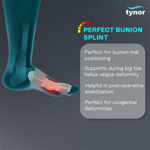 2-Pack Bunion Corrector For Women – Adjustable With Toe