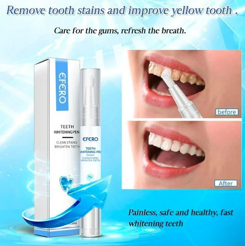 EferoWP Teeth Whitening Pen, Teeth Whitening Gel, Whiter Teeth