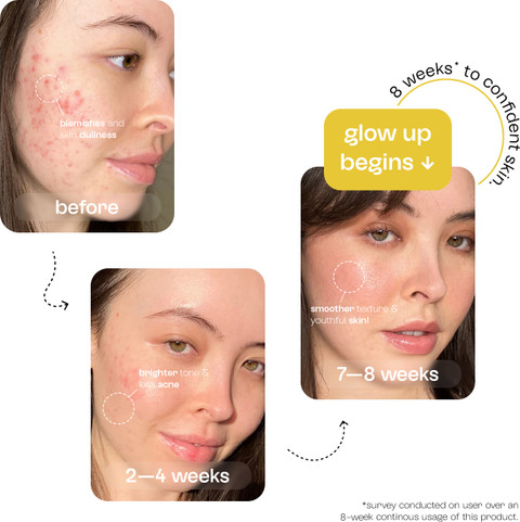 ghk-cu stack with cjc-1295 ipamorelin safety Glutathione 4X Skin Serum Golden Pearl main image 0