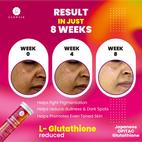 G GLOWSIK -600mg Japanese Opitac Glutathione Effervescent Tablet, Acne Free  , Glowing Skin Price in India