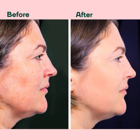 antioxidant glutathione health benefits What Is Glutathione? Benefits, Supplements & Risks https://bit.ly/4pQsHOQ