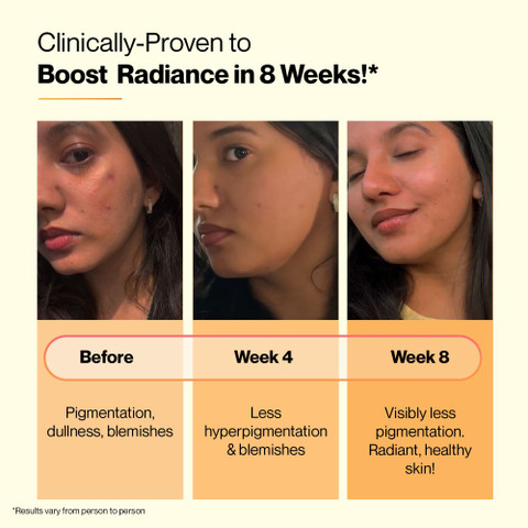 before and after glutathione pills results SETU Skin Renew Glutathione 500mg Tablets with Vitamin C Mixed Berry &  Orange Combo Price in India