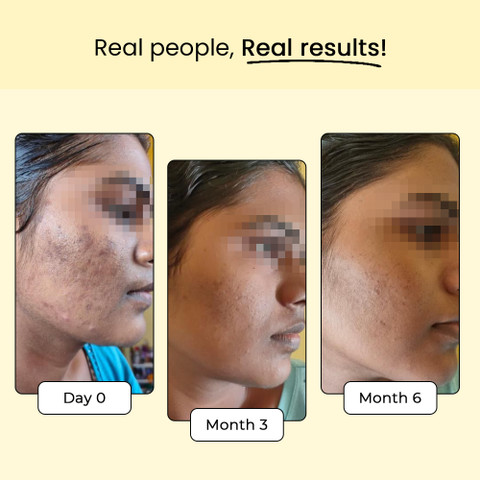 what is l glutathione made from L-Glutathione | Ingredient Guide