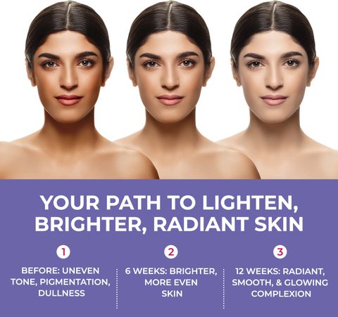best glutathione injection reviews glutathione skin lightening reviews Best Supplement for Glowing Skin? best glutathione injection reviews glutathione skin lightening reviews Best Supplement for Glowing Skin?