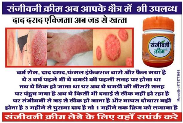 V_GADGETS Herbal Ayurvedic Fungal Infection cream, 25 g Antiseptic Cream