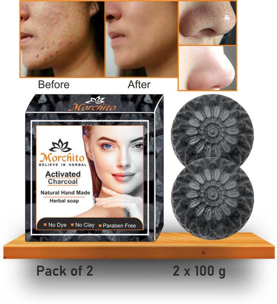 Morchito Activated Charcoal Soap For Men & Women , Acne , Blackheads , Pimples & Skin Whitening Face & Body Soap