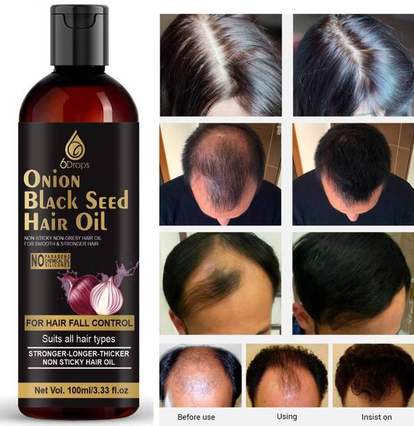 6Drops Onion Oil - Black Seed Onion Hair Oil - Controls...