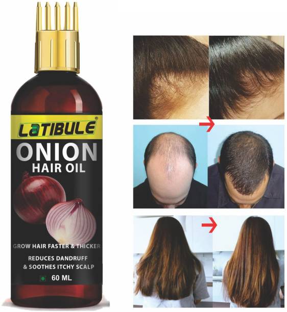 Latibule Onion Black Seed Hair Oil - WITH COMB APPLICATOR - Controls Hair Fall - NO Mineral Oil, Silicones, Cooking Oil , Synthetic Fragrance  Hair Oil