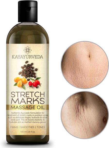 KAYAYURVEDA Stretch Marks Oil