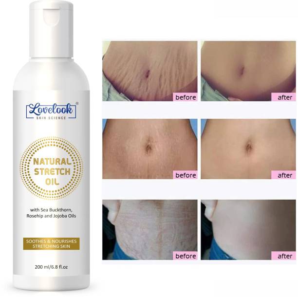 Lovelook Natural Stretch Oil with Coconut, Olive & Jojoba Oils, For Scars & Stretchmarks
