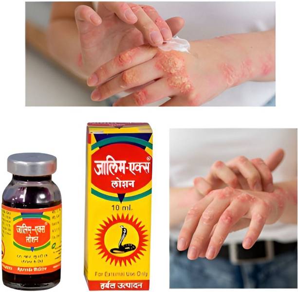 ANJU PHARMACEUTICALS Zalim X Lotion Ayurvedic Skin Care For Ringworm and Itches Antiseptic Liquid