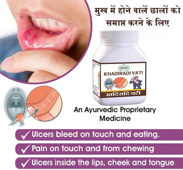 Gunmala Mouth Ulcer Relief Tablet (Khadiradi Vati) For Sore Throat & Oral Health-60 Tab