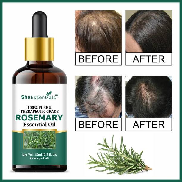 She Essentials Rosemary Essential Oil 100% Natural & Pure for Hair Growth, Skin & Aromatherapy