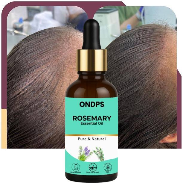ONDPS Pure Rosemary Essential Oil for Hair Growth & Scalp Nourishment Hair Oil