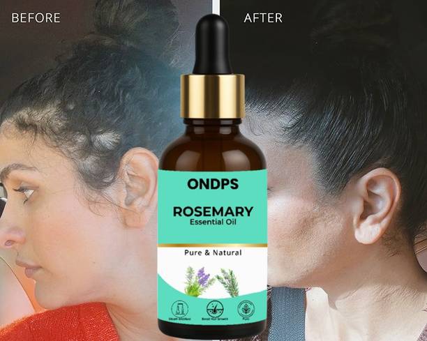ONDPS Rosemary Essential Oil for Hair Growth, Clinically Proven, Fall Control VCD5