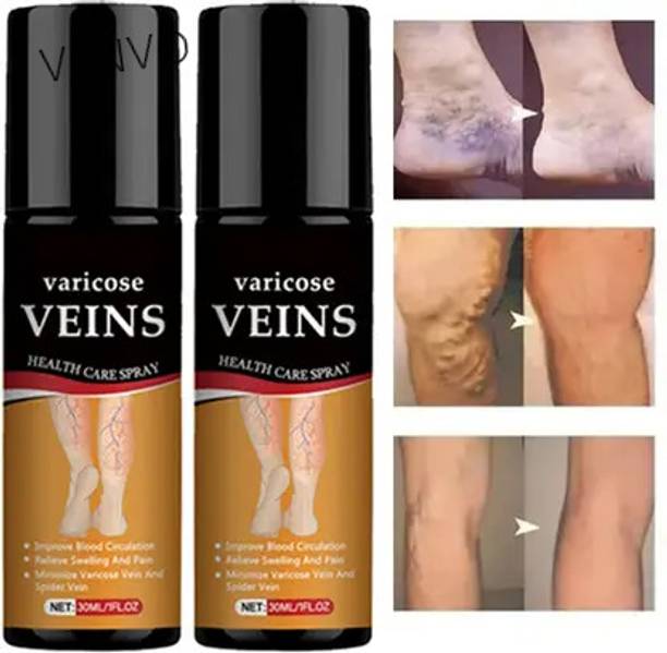 venvo Varicose Vein Spray Herbal Comfort Quick Absorb Pack of 2 Spray