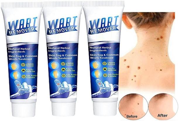 YAWI Cream-Quickly and Easily Remove Wart Remover Cream