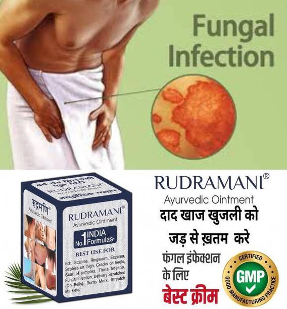 Rudramani Marham Malam For itching Cream ,Dad Khaj Khujli, Skin Infection, Skin Treatment