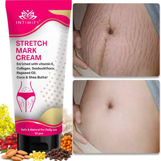 INTIMIFY Stretch Marks Removal Cream, Reduce Scar Before & After Pregnancy For Women