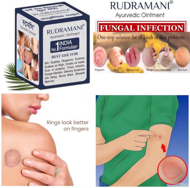 Rudramani Marham Malam Ayurvedic for Skin Anti Fungal Infection, Itching, Ringworm, Eczema