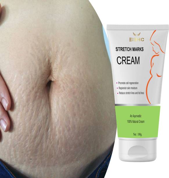 EIBHC Body stretch mark removal Cream teenage stretch marks solutions naturally Price in India