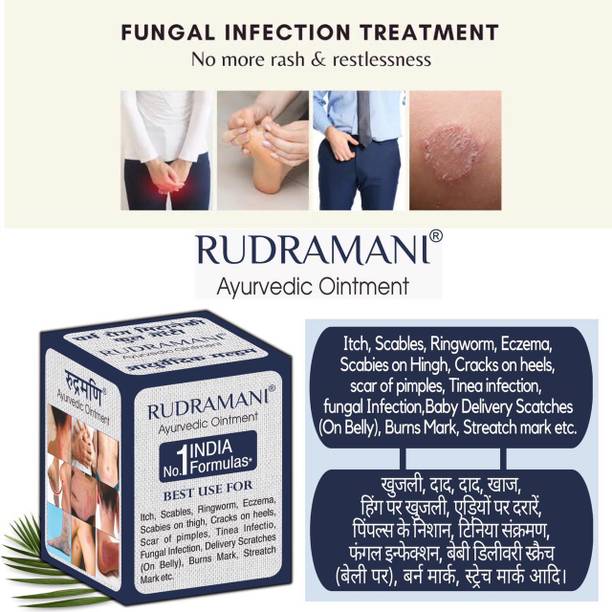 Rudramani Ayurvedic Anti fungal Malam Pimple,Ringworm,itching,Skin Infection,Skin Tretment