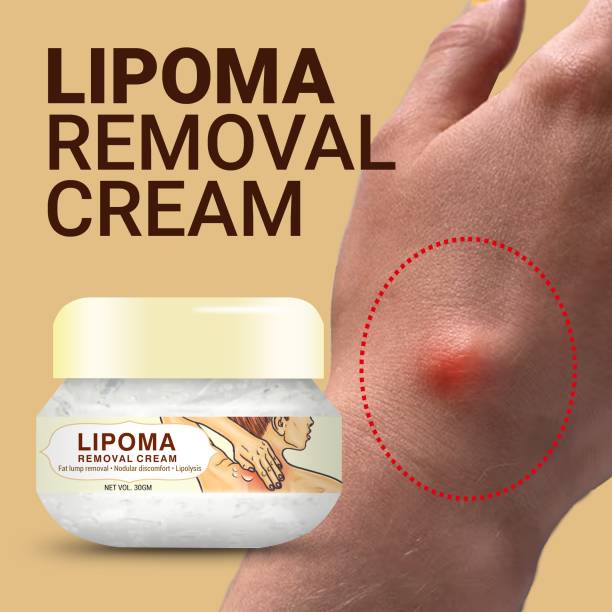 WAYMORE Lipoma Remover Cream Painless Herbal Lipolysis Fat Relief for Men & Women