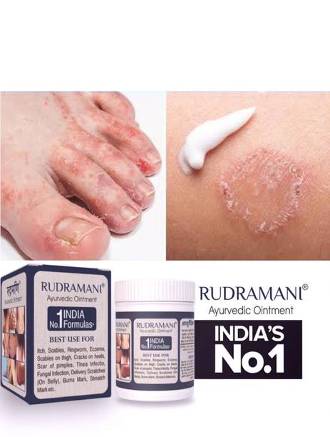 Rudramani For Eczema skin Fungal Ointment,Ayurvedic Malam skin,Khujli cream skin Infection