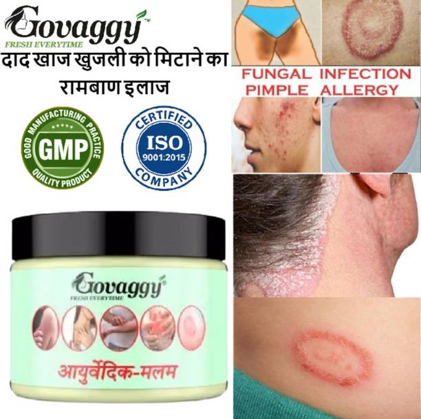 Govaggy Ayurvedic Anti fungal Malam for Ringworm, itching, Eczema and Fungal Infection
