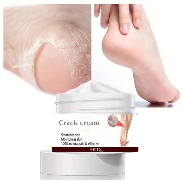 Emijun Foot Crack Cream For Dry Cracked Heels & Feet