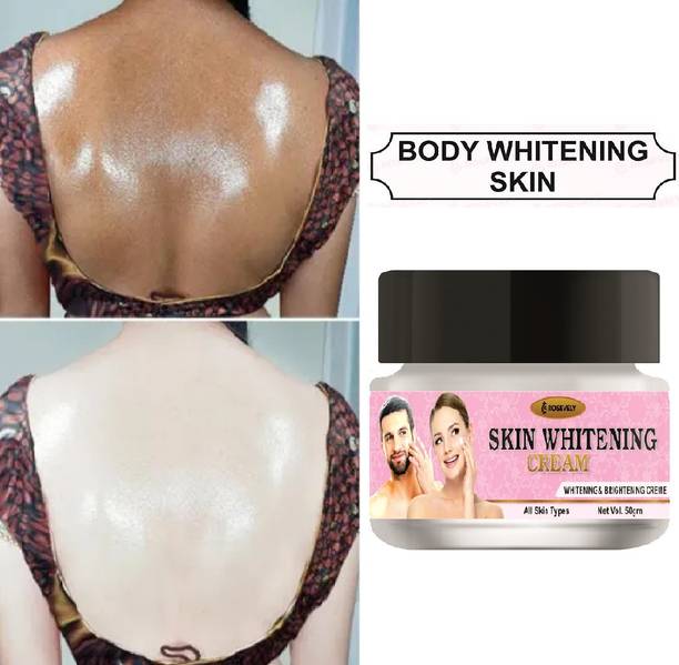 Rosevely Skin Whitening Daily Day & Night Cream For Men & Women