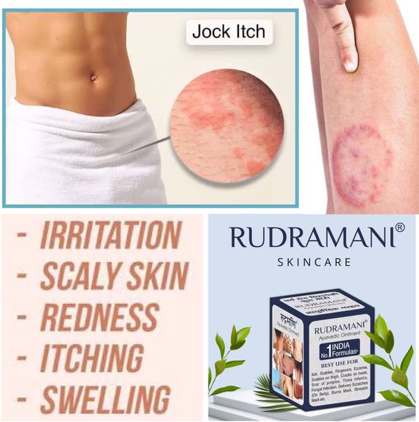 Rudramani Ringworm Ointment -25gm Pack of-1