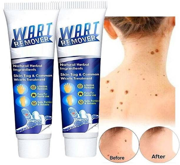 YAWI Wart Remover Cream-Quickly and Easily Remove