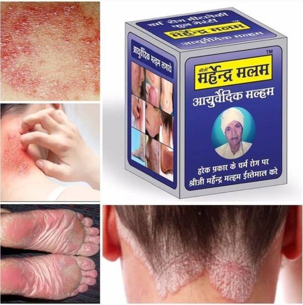 Shreeji Marhendra Anti Fungal Malam -Dad Khaj itch Relief Treatment Ke Liye Marham, itching Cream.