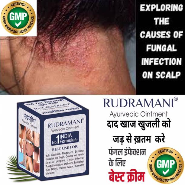 Rudramani Marham Malam For-Itching, Dad Khaj Khujli , Any Skin Infection, Skin Treatment .