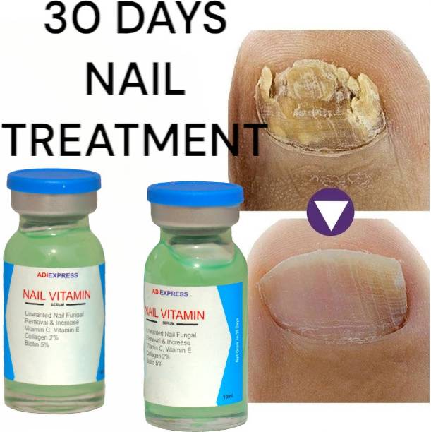 Adi Express nail infection medicine,fungus toe 35DAYS broken nail repair gel