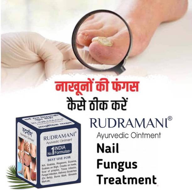 Rudramani Ayurvedic skin Burs cream. itching fungal Malam for onilment,skinCream