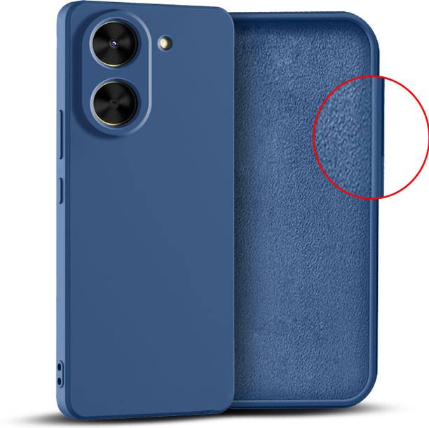 Flipkart SmartBuy Back Cover for Mi Redmi 5, REDMI A5