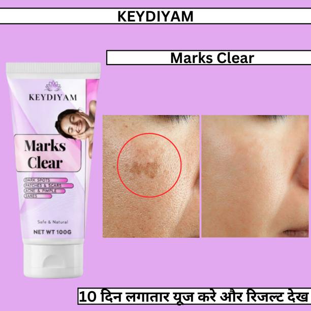 keydiyam Dark Spot Remover WOMEN for Face, Dark Spot Corrector Cream
