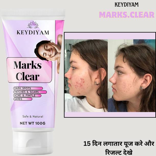 keydiyam Dark Spot Remover for Face, Dark Spot Corrector CreamWhitening Cream