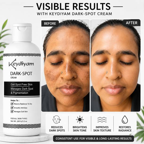 keydiyam DARK SPOT face cream